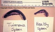 Tularemia - Spleen